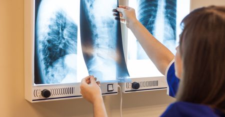 Samsung wprowadza SI do radiologii – diagnozy początkujących lekarzy będą trafniejsze