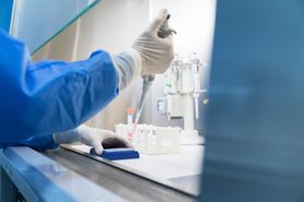 GIS uspokaja: to nie była cholera. Czym różni się od wibriozy?