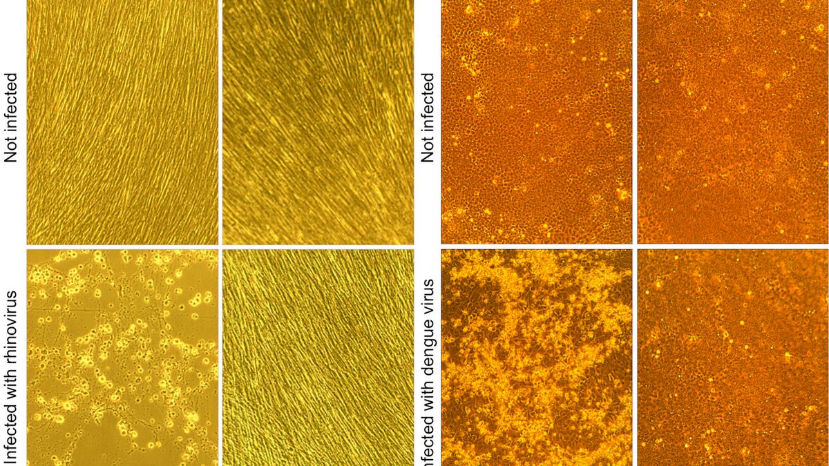 Antybiotyk na wirusy - lekarstwo wymorduje zarażone komórki 1