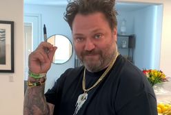 Bam Margera walczy w szpitalu. 43-latek jest wrakiem człowieka