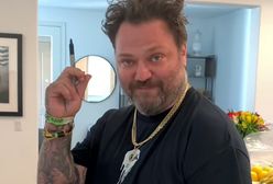 Bam Margera walczy w szpitalu. 43-latek jest wrakiem człowieka