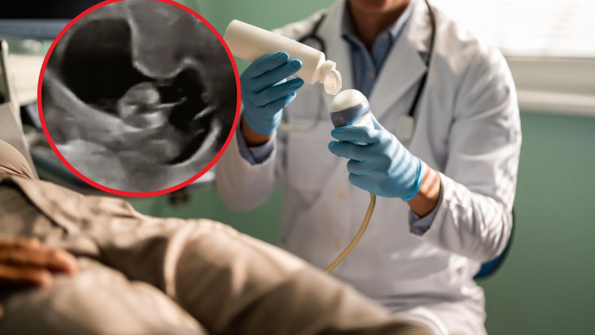 Badanie ultrasonograficzne uchwyciło moment, w którym płód ma czkawkę