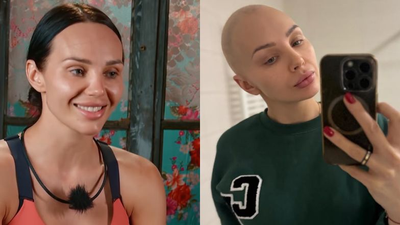 Arwena Tarasiuk-Wilczewska relacjonuje walkę z rakiem