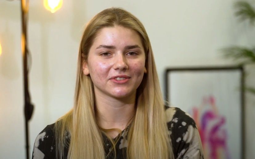 Julia Żugaj walczyła z trądzikiem
