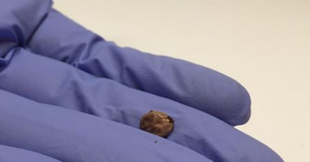 Uważaj na groźne nimfy kleszcza. Można je łatwo pomylić z pieprzykiem
