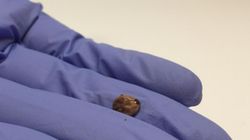 Uważaj na groźne nimfy kleszcza. Można je łatwo pomylić z pieprzykiem 