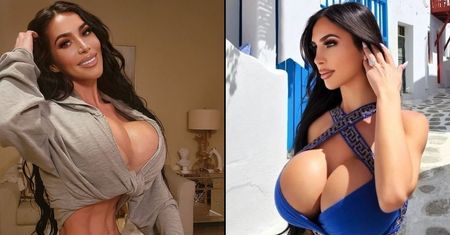 Chciała wyglądać jak Kim Kardashian. Zmarła na skutek operacji plastycznej