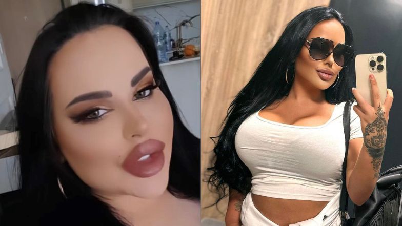 Esmeralda Godlewska jest załamana liftingiem piersi