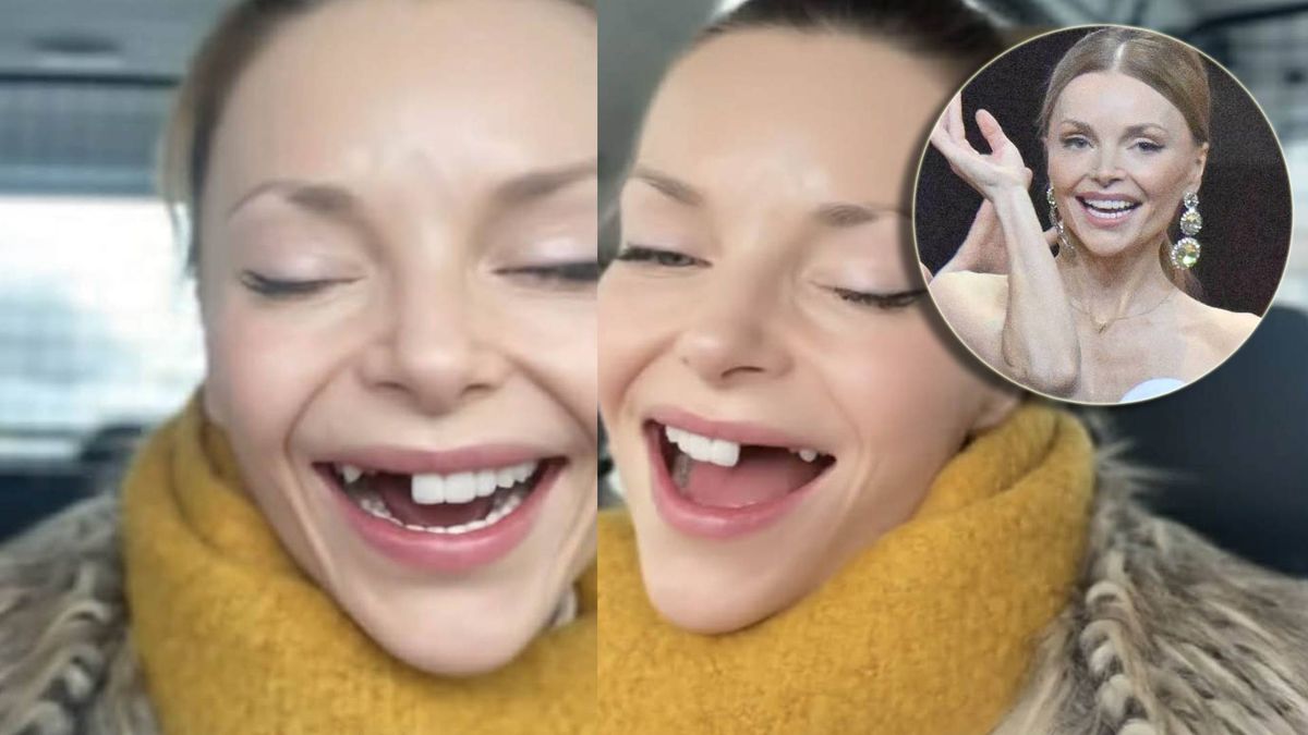 Iza Miko bez zębów