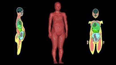 Badania wpływu pola EM na człowieka 1