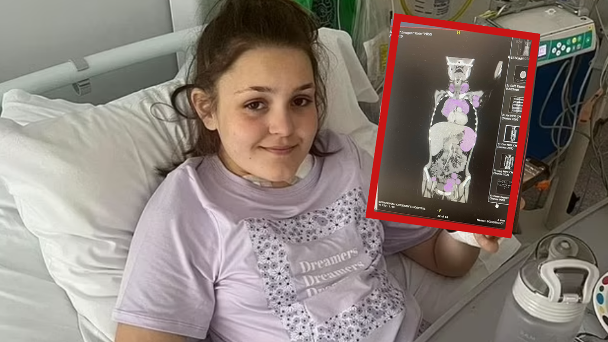 Pierwsze objawy choroby przypominały grypę. U 12-latki zdiagnozowano rzadki nowotwór
