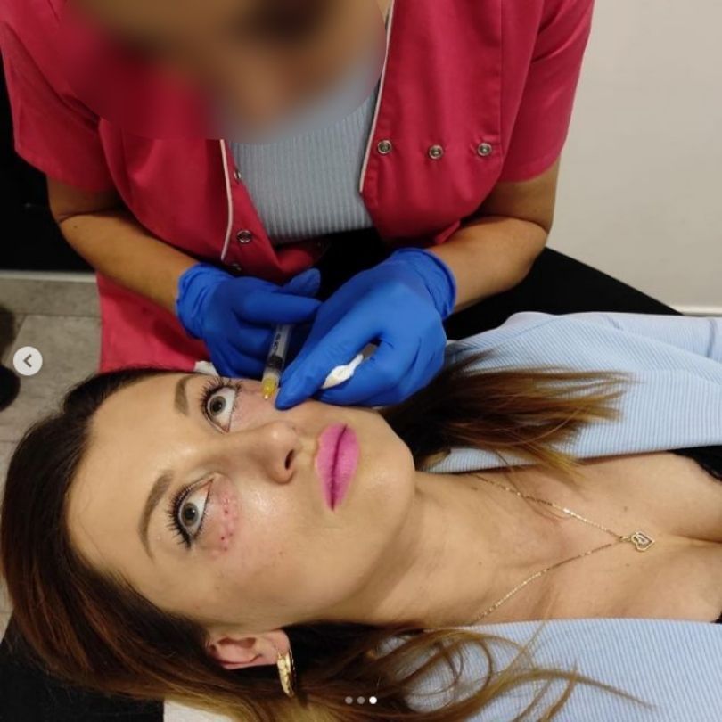 Justyna Żyła relacjonuje wizytę w klinice medycyny estetycznej