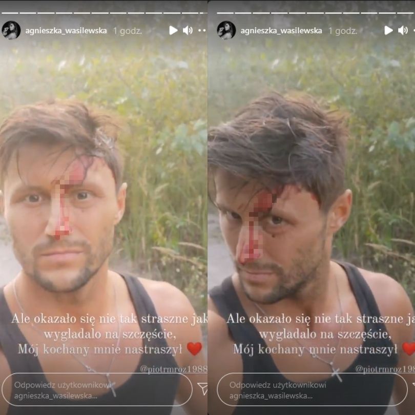 Piotr Mróz miał wypadek samochodowy. Jego ukochana zrelacjonowała zdarzenie w sieci