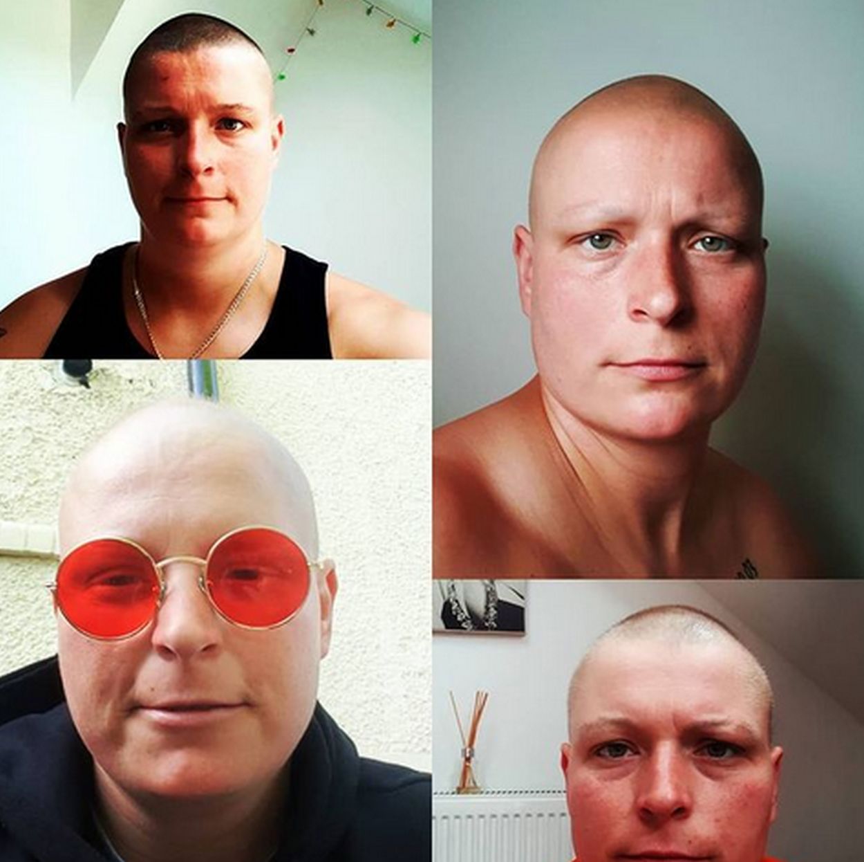 Natalia Dawidowska z "Big Brothera" o chorobie nowotworowej i przykrych komentarzach
