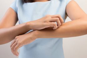 Swędzenie skóry – co może oznaczać?