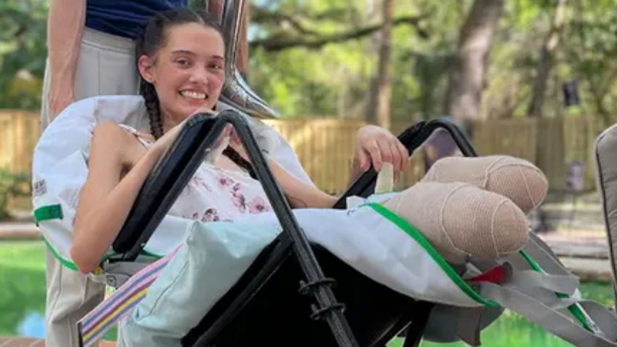 Modelka straciła obie nogi przez zakażenie koronawirusem