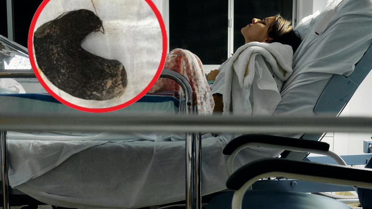 Myśleli, że to guz. Byli w szoku, gdy zbadali żołądek nastolatki