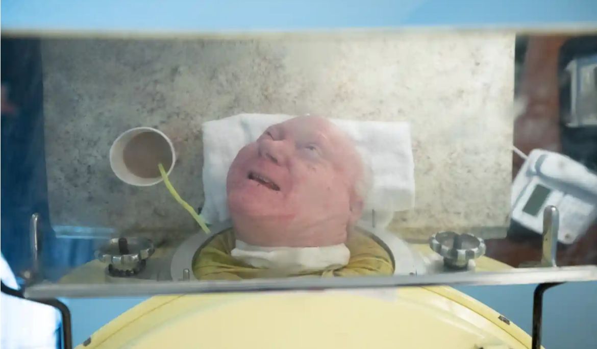 Paul Alexander zachorował w wieku sześciu lat