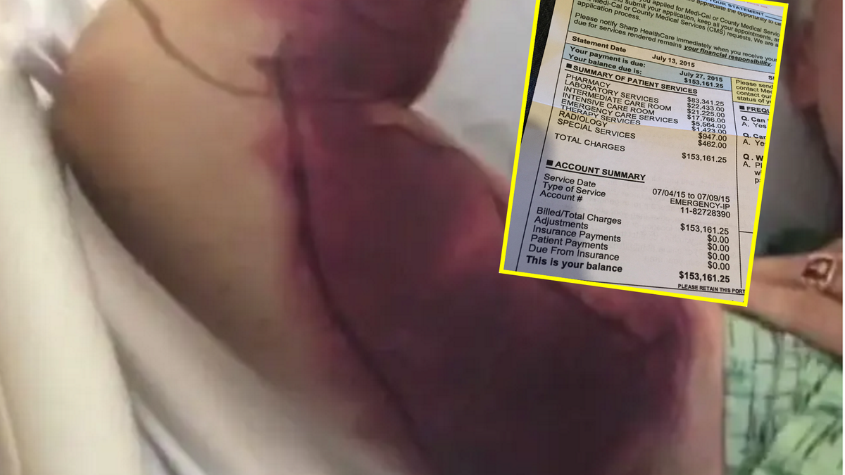 Trucizna zainfekowała rękę mężcyzny