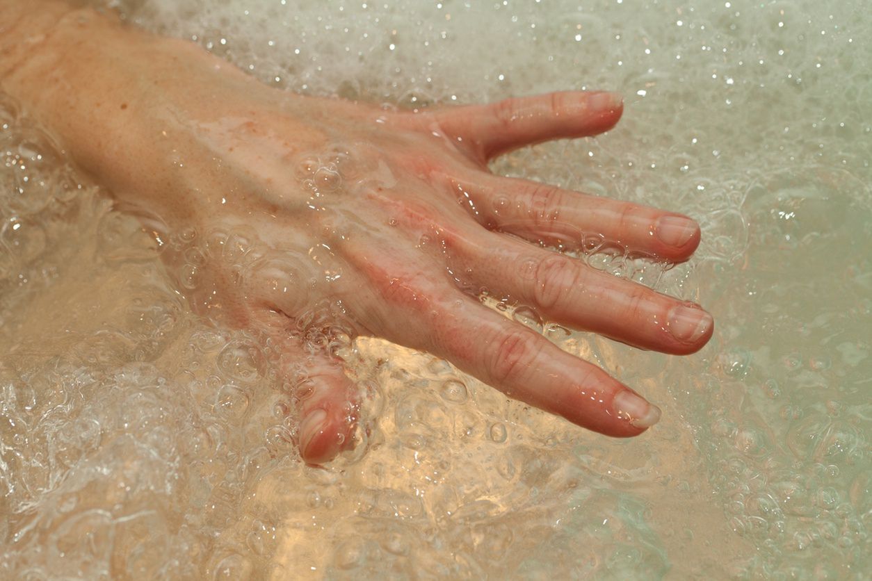Opuchnięte dłonie mogą wskazywać na poważne choroby