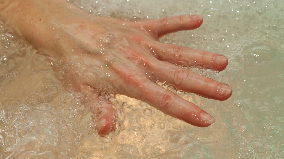 Opuchnięte dłonie mogą wskazywać na poważne choroby