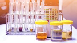 Płyny ustrojowe - czym są i jakie pełnią funkcje