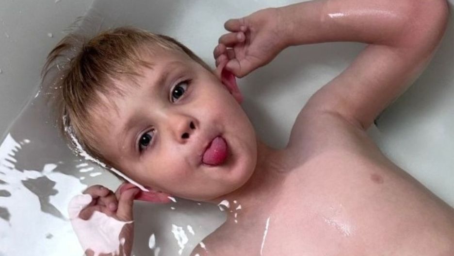 Kleszcz na ciele dziecka