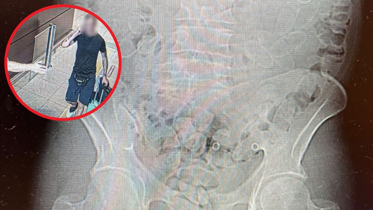 40-latek połknął 88 kapsułek z narkotykami