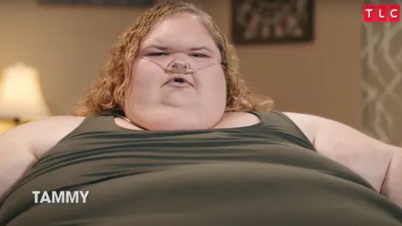 Tammy Slaton przeszła operację usuwania skóry