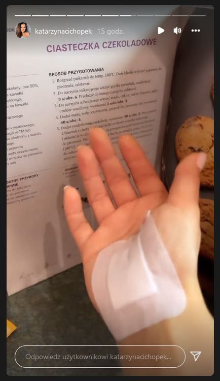 Kasia Cichopek przeszła operację ręki