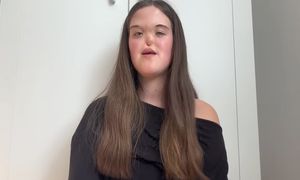 Paulina urodziła się bez nosa. "To był szok dla lekarzy"