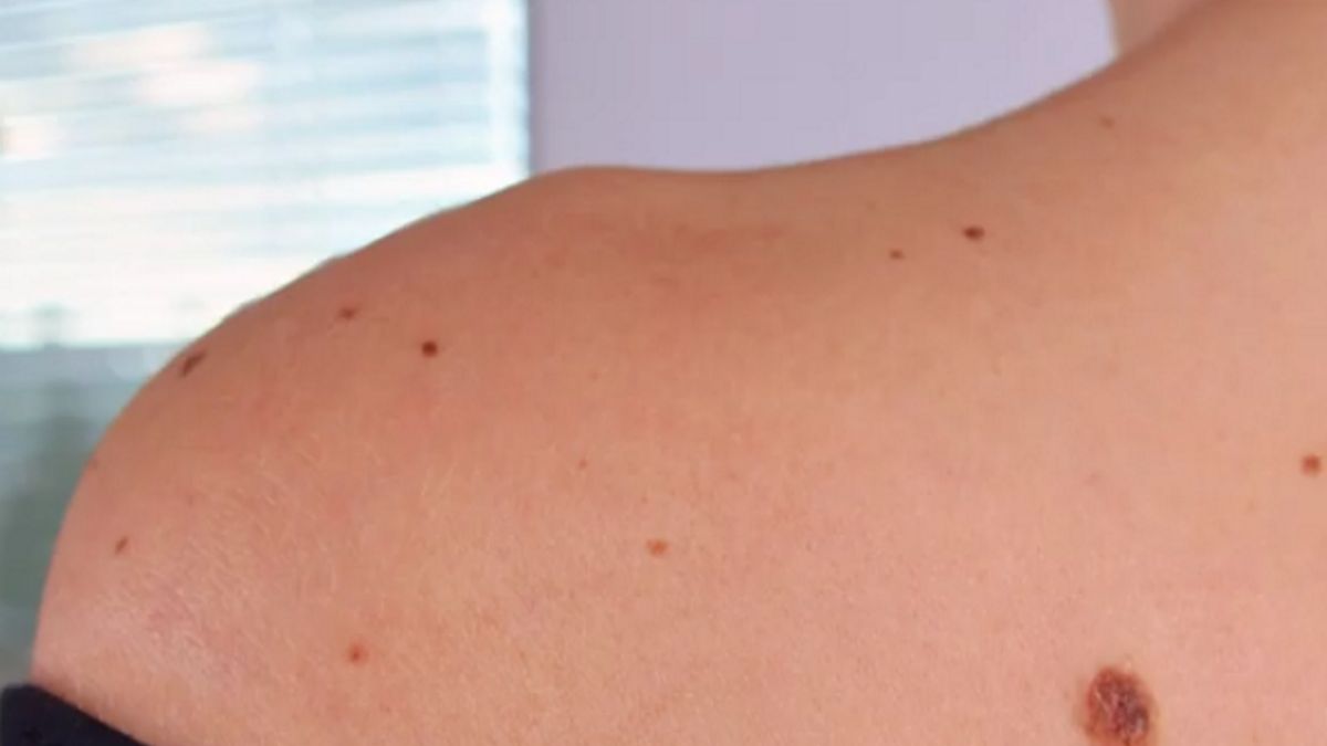 Zdjęcie ilustracyjne