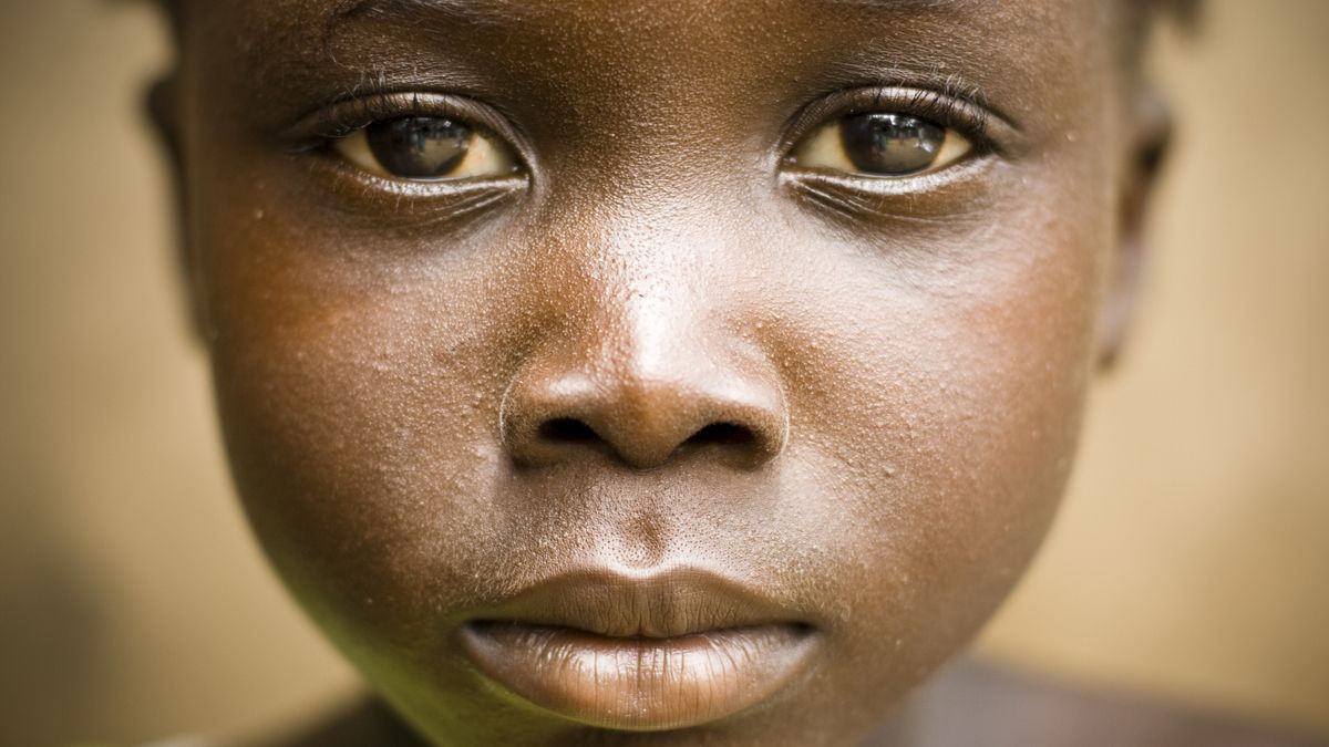 Klęska głodu może dotknąć nawet 31 mln mieszkańców Afryki