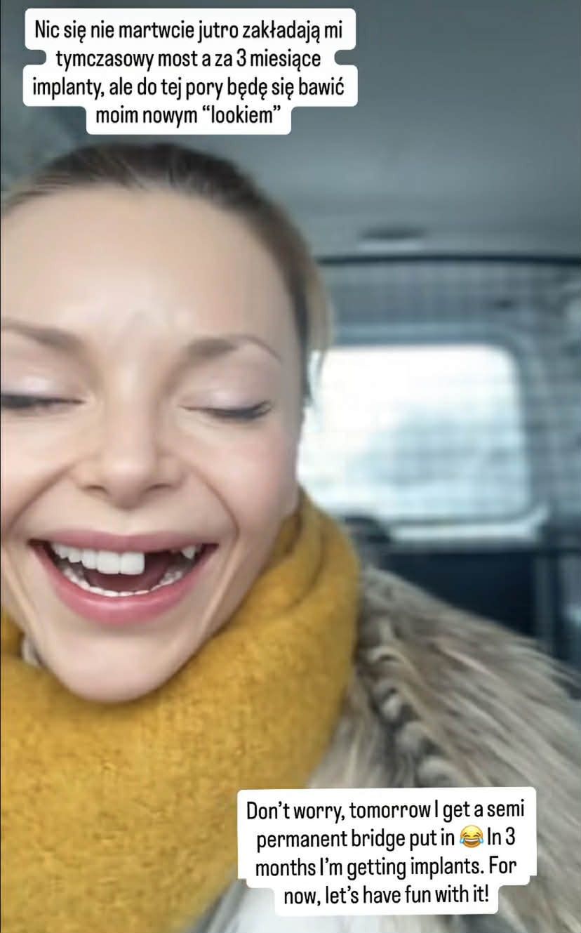 Iza Miko pokazała braki w uzębieniu