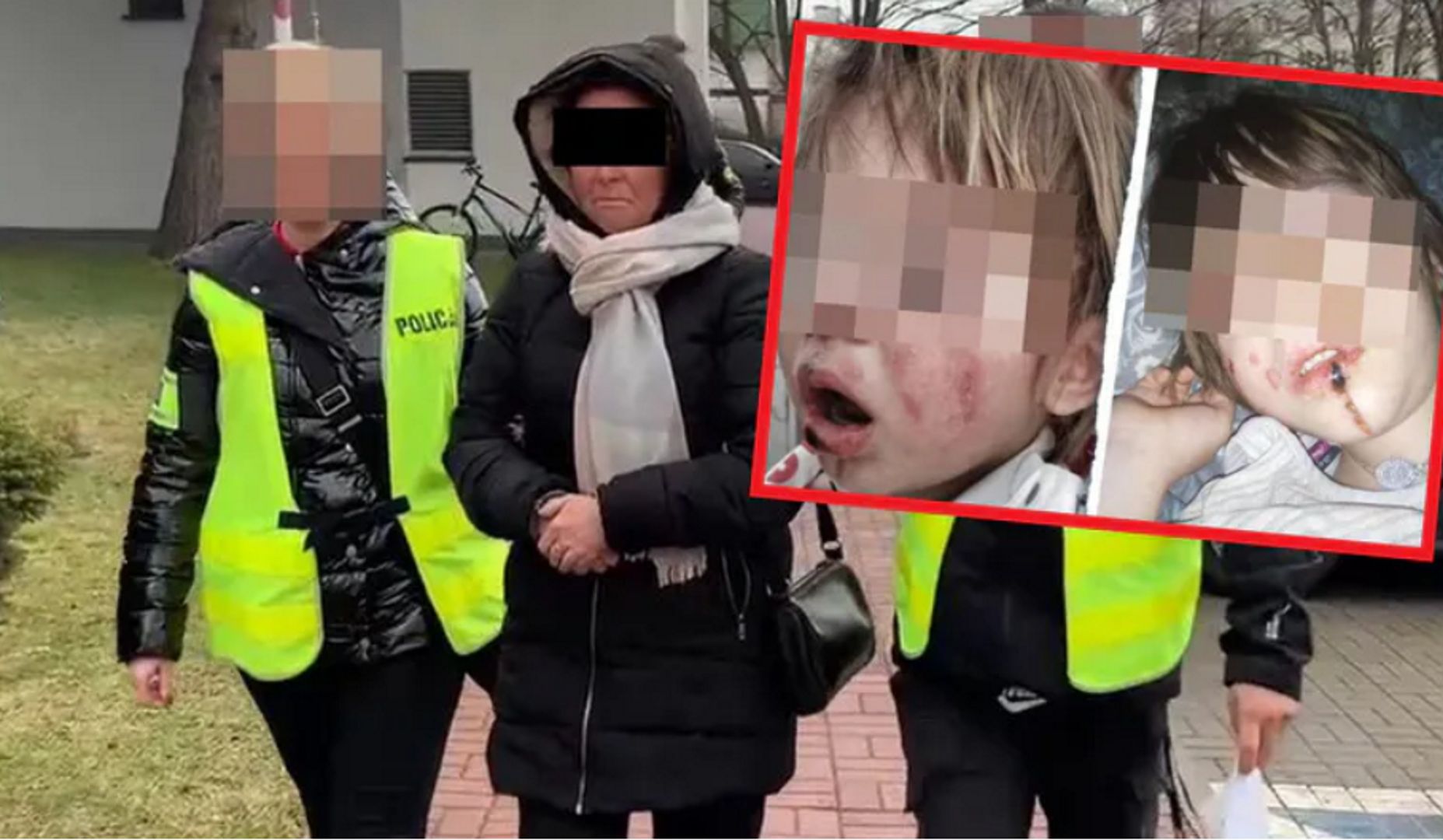 Matka z piekła rodem. Oszpecała córkę substancją żrącą. Jest akt oskarżenia