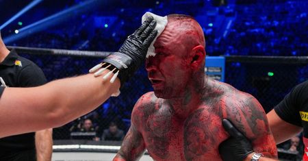 W KSW stoczył krwawą wojnę. Tak wygląda jego twarz