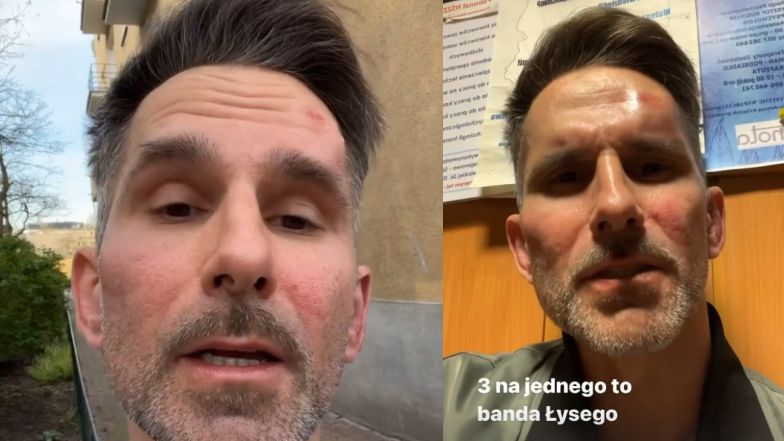 Marcin Bosak został pobity. Mamy komentarz policji