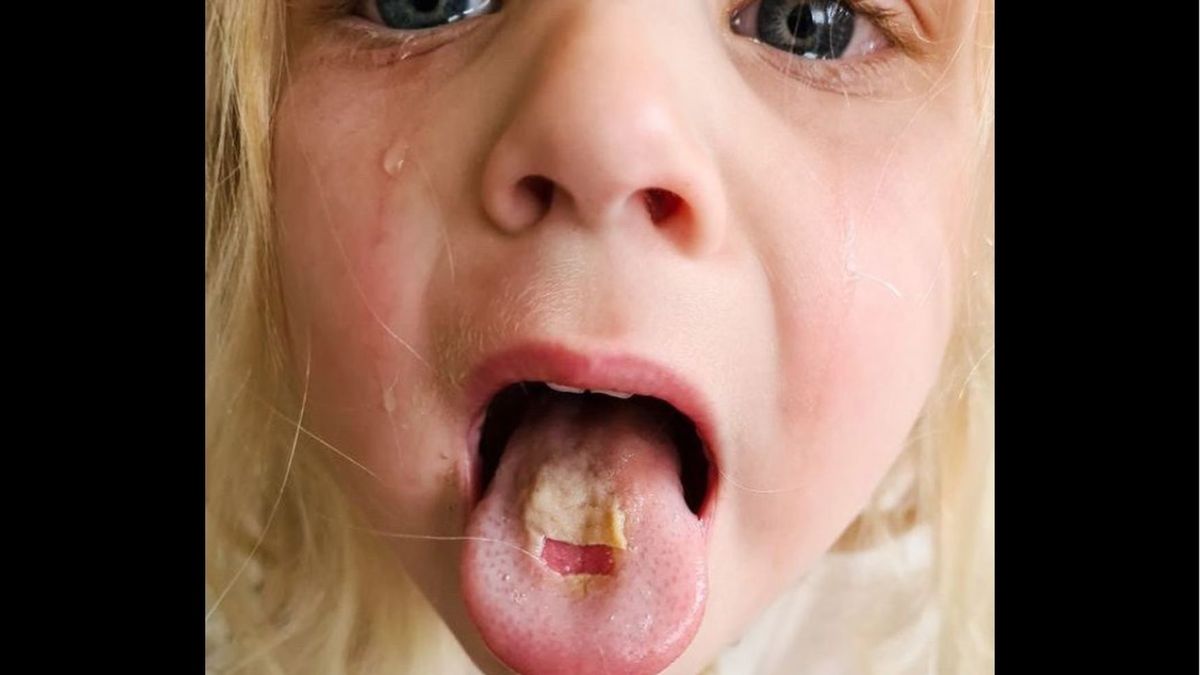 Nie podawaj dziecku tych słodyczy. Mogą poparzyć język