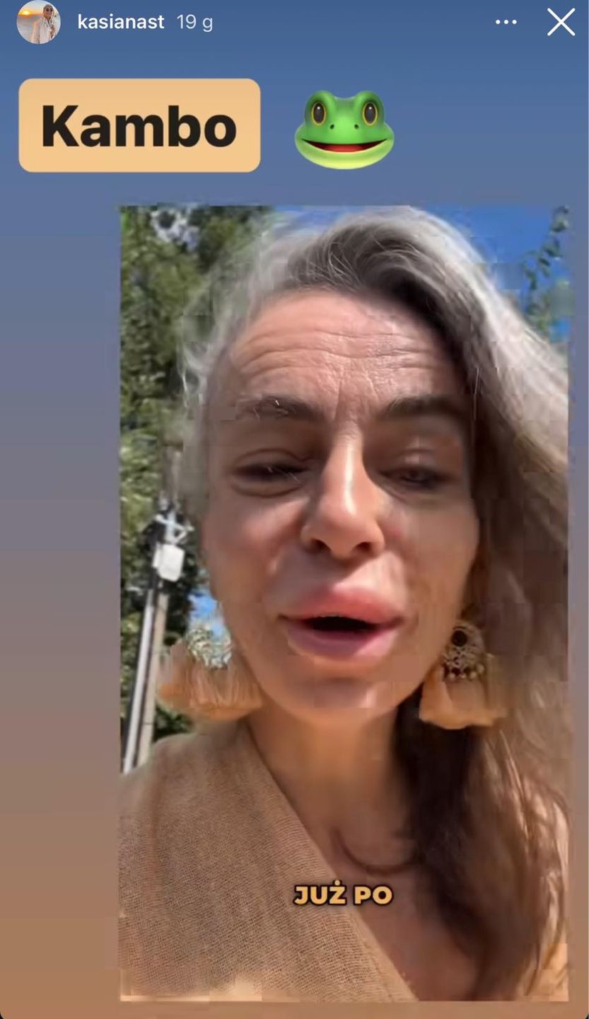 Kasia Nast wstrzyknęła sobie jad żaby