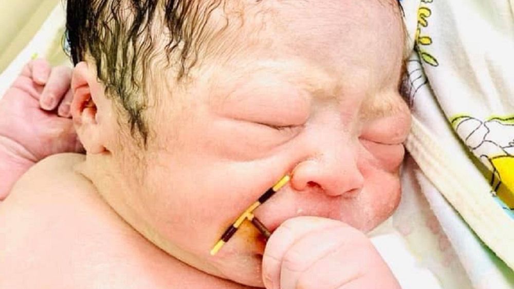 Noworodek trzymał w ręku wkładkę domaciczną