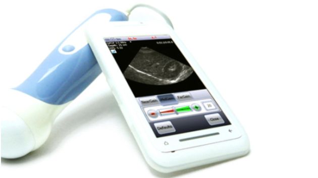 Przenośne smartfonowe USG trafia do sprzedaży! 1