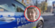 W takim stanie była Mirella ze Świętochłowic. "Dziury aż do kości"