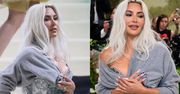 Co się stało z DŁOŃMI Kim Kardashian? Ekspertka twierdzi, że zafundowała sobie WYPEŁNIACZE przed Met Galą (ZDJĘCIA)