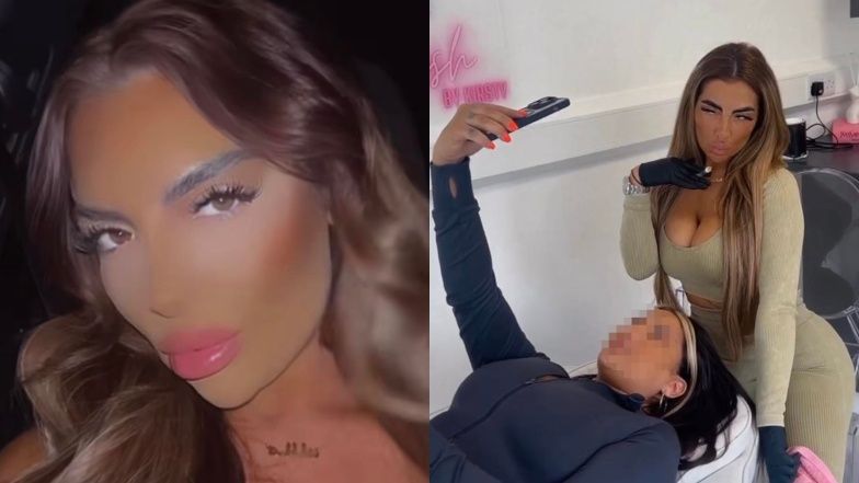 30-letnia Brytyjka otarła się o śmierć po zabiegu upiększającym