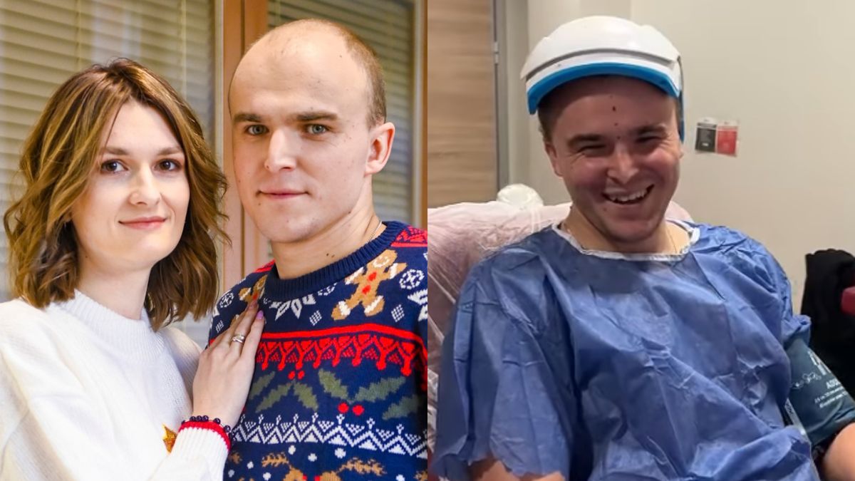 Kamil zafundował sobie przeszczep włosów