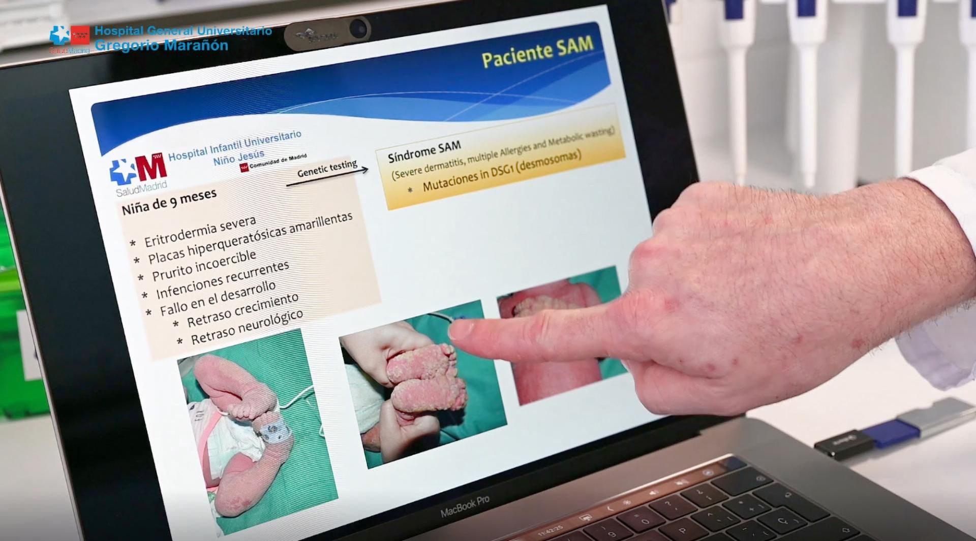 Lekarz analizujący stan skóry małej pacjentki