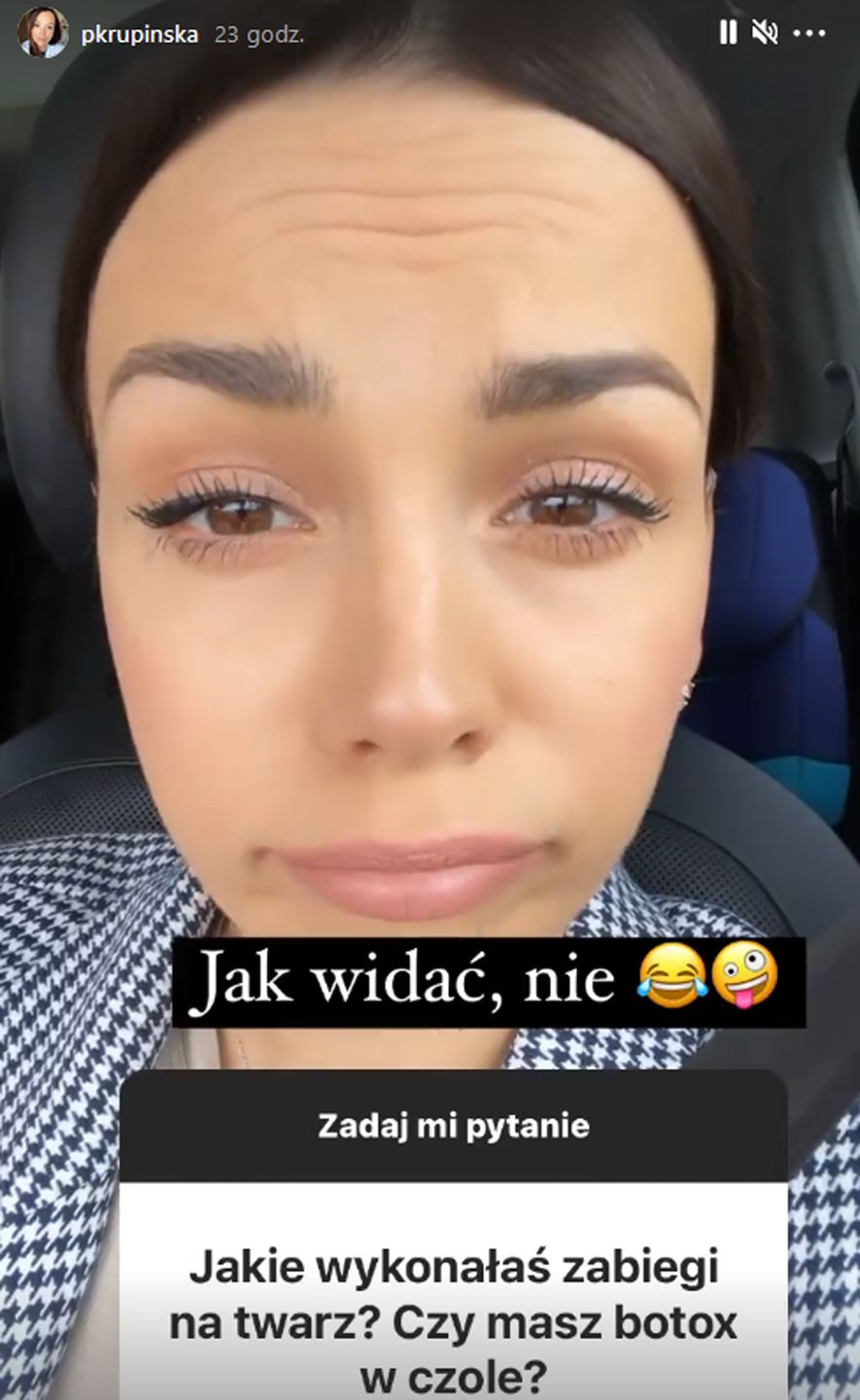Paulina Krupińska przekonuje, że nie ma botoksu