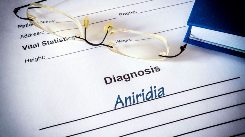 Aniridia to zaburzenie rozwojowe, polegające na całkowitym lub częściowym braku tęczówki oka. Ta nie rozwinęła się prawidłowo w życiu płodowym. 