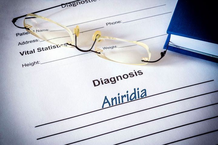 Aniridia to zaburzenie rozwojowe, polegające na całkowitym lub częściowym braku tęczówki oka. Ta nie rozwinęła się prawidłowo w życiu płodowym. 