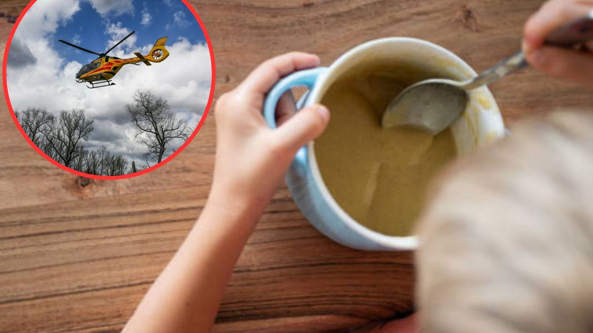 Dwulatek wylał na siebie gorącą zupę. Ma poparzone 30 proc. ciała
